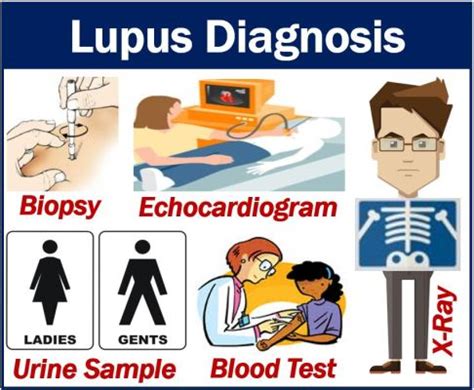 Diagnosing lupus: Types of blood tests a doctor may order.